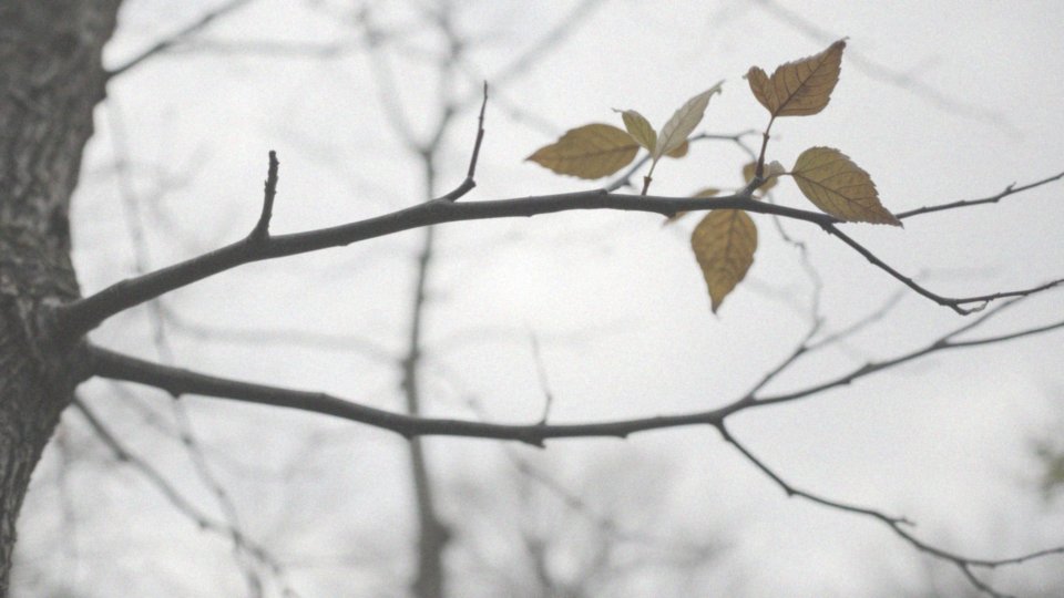 Objawy jaskry u dorosłych – jak je rozpoznać i leczenie